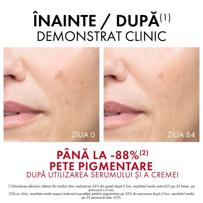 Liftactiv B3 crema anti-pete pigmentare SPF 50+, 50ml, Vichy