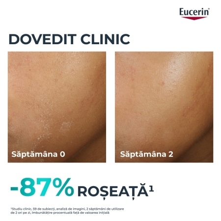 Fluid pentru fata hidratant DermoPure, 40 ml, Eucerin Fluid pentru fata hidratant DermoPure, 40 ml, Eucerin