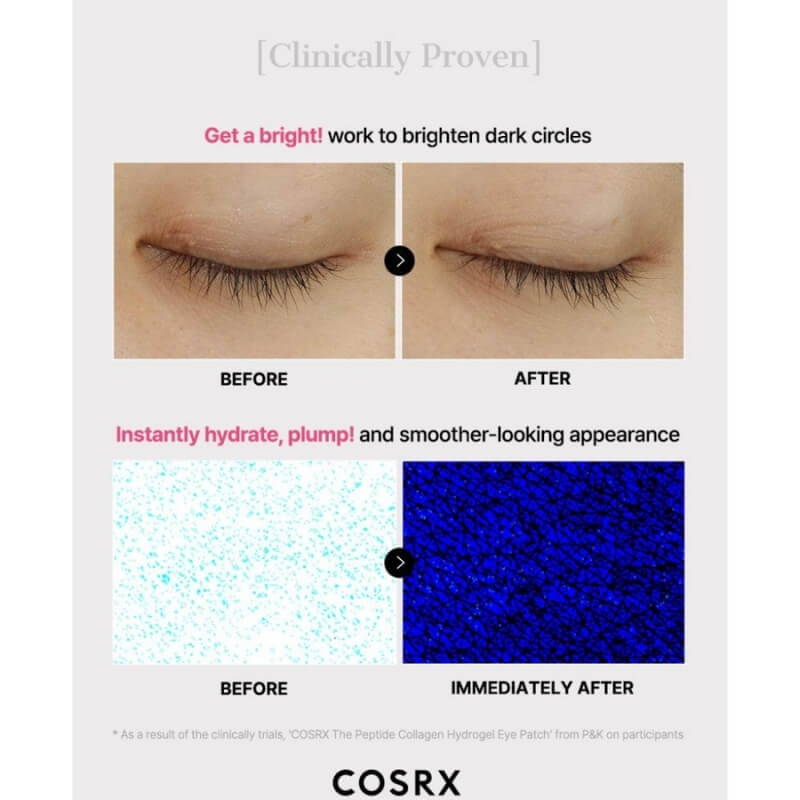 Plasturi Din Hidrogel Pentru Ochi Cu Colagen Si Peptide, 60 bucati, Cosrx Plasturi Din Hidrogel Pentru Ochi Cu Colagen Si Peptide, 60 bucati, Cosrx