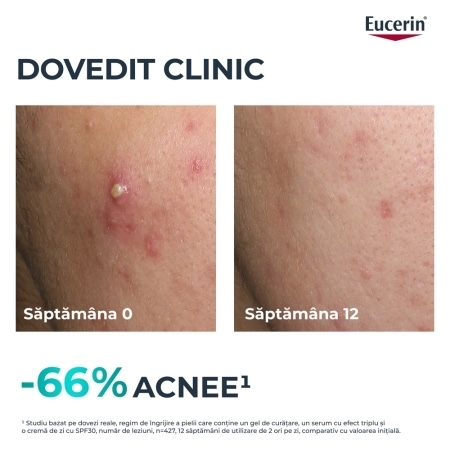 Ser cu tripla actiune DermoPure, 40 ml, Eucerin Ser cu tripla actiune DermoPure, 40 ml, Eucerin