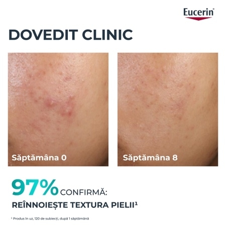 Tratament exfoliant pentru noapte DermoPure, 40 ml, Eucerin Tratament exfoliant pentru noapte DermoPure, 40 ml, Eucerin